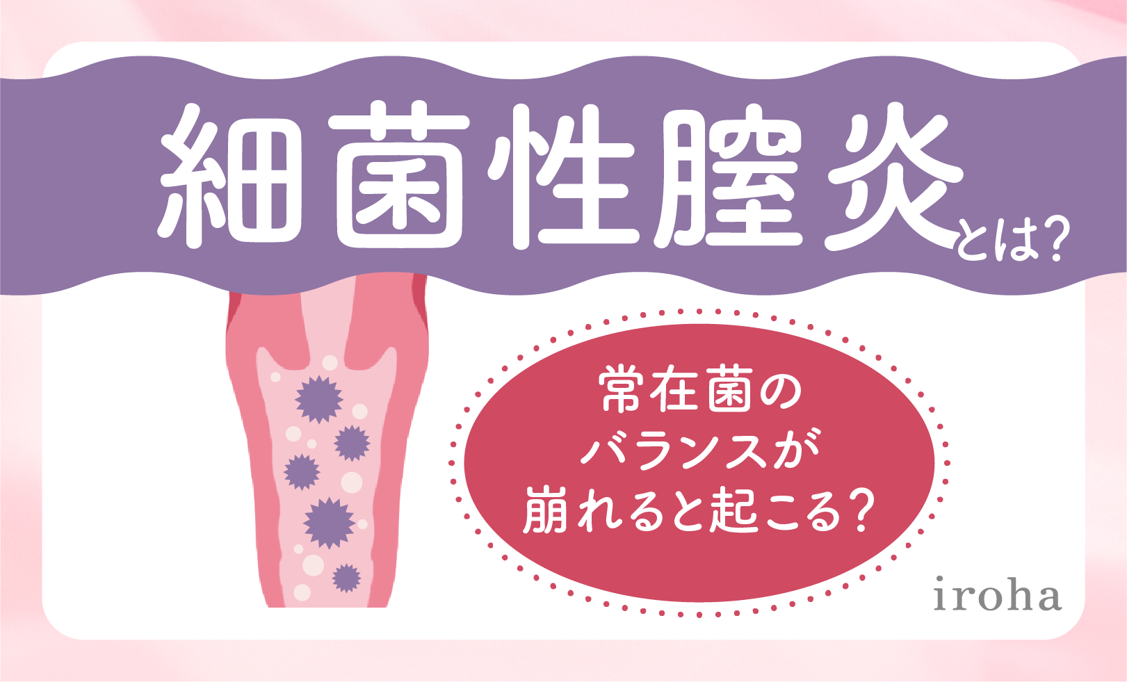 細菌性膣炎_アイキャッチ画像